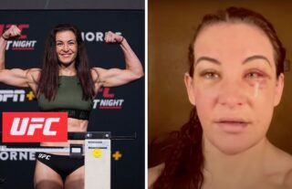 Miesha Tate gave MMA fans a look at how she removed her own stitches following her defeat to Ketlen Vieira at UFC Vegas 43