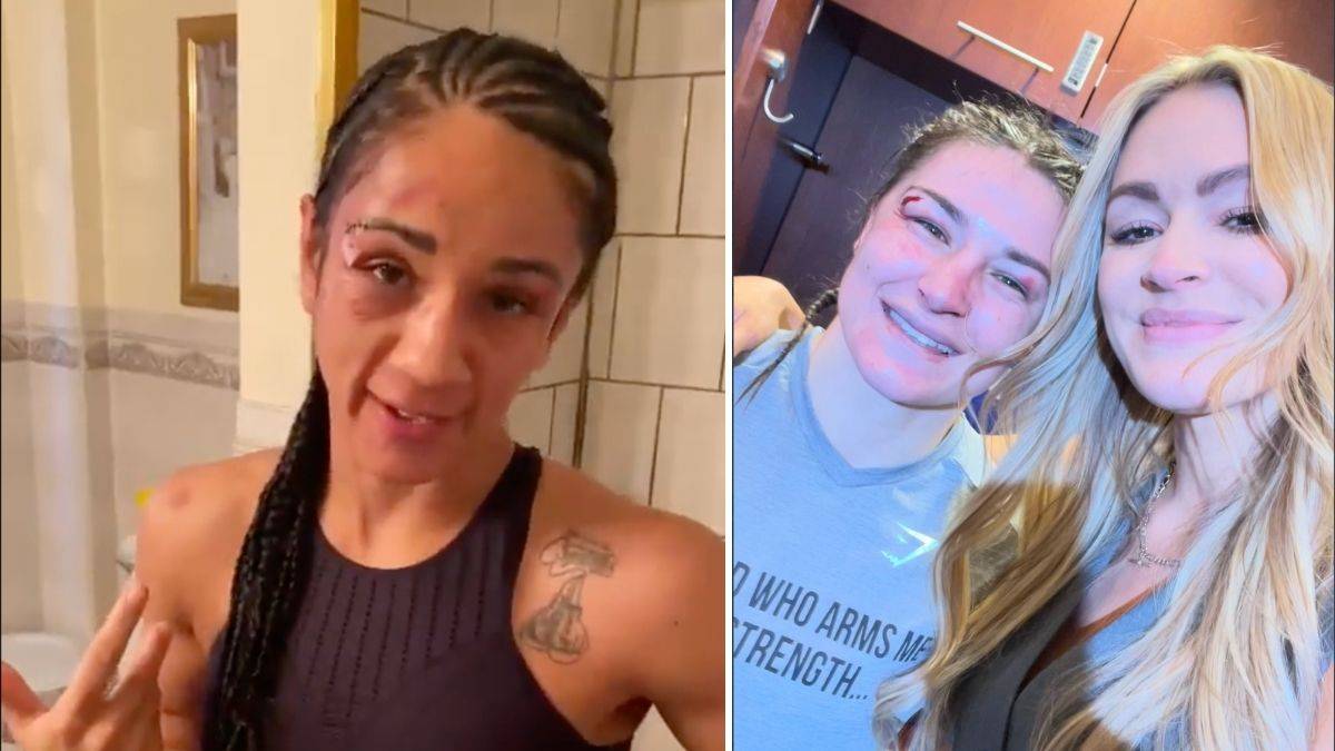 Amanda Serrano and Katie Taylor bruised faces