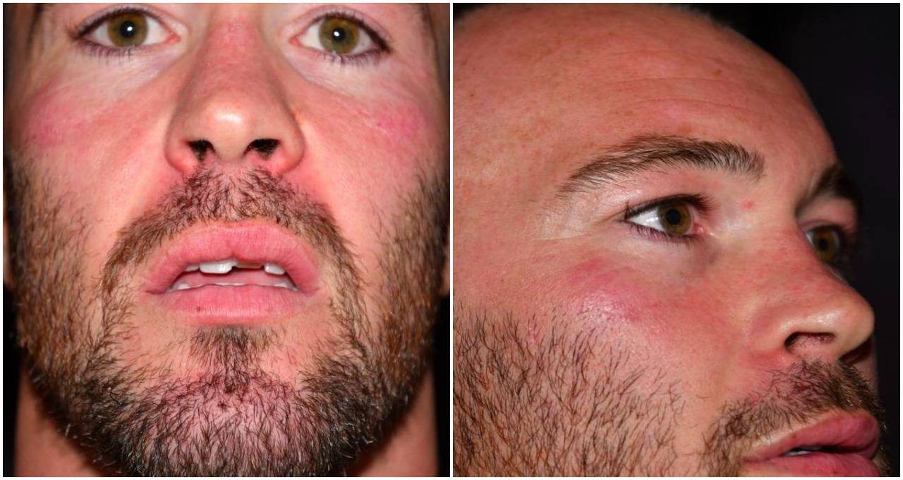colby-covington-jorge-masvidal-alleged-attack-injury-images