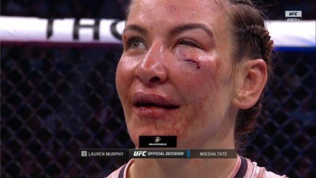 UFC Fight Night Ortega vs Rodriguez Miesha Tate Bloody