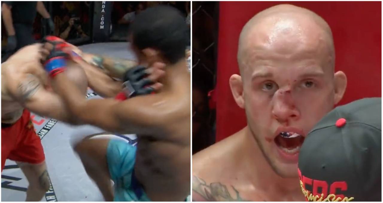 Worst broken nose in MMA history? Blake Perry's is absolutely brutal