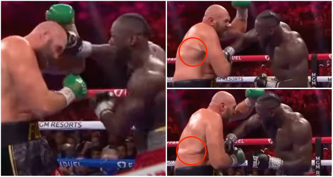 Deontay Wilder sending literal ripples through Tyson Fury's body with one punch