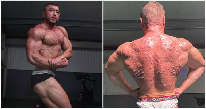 Bodybuilder-Shows-Off-Impact-Of-Taking-Steroids