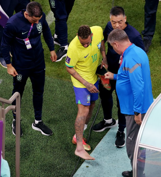Neymar's swollen ankle